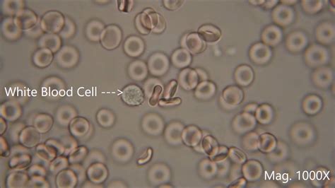 Red Blood Cells Microscope Labeled