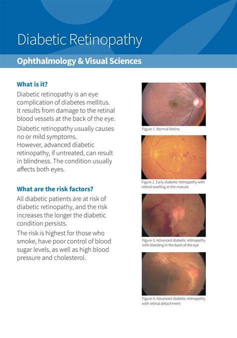 Bahnhof Literaturverzeichnis Optimismus signs diabetic retinopathy ...