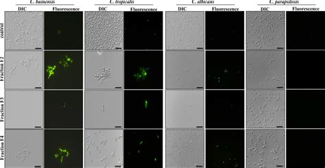 Membrane permeabilization assay. Photomicrography of different yeast ...