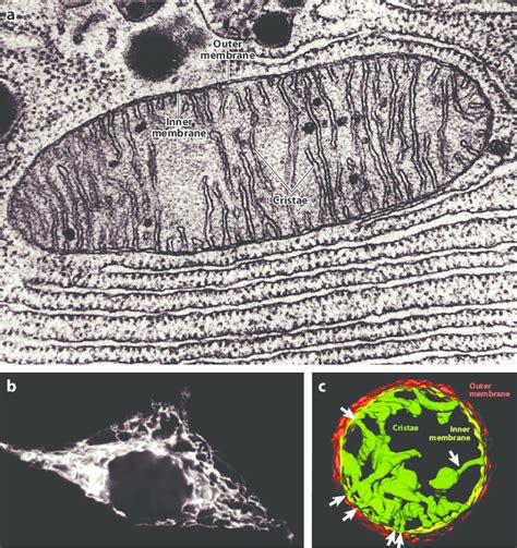 Mitochondria Electron Microscope