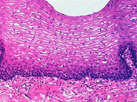 Non Keratinized Stratified Squamous Epithelium - JessieewaHenson