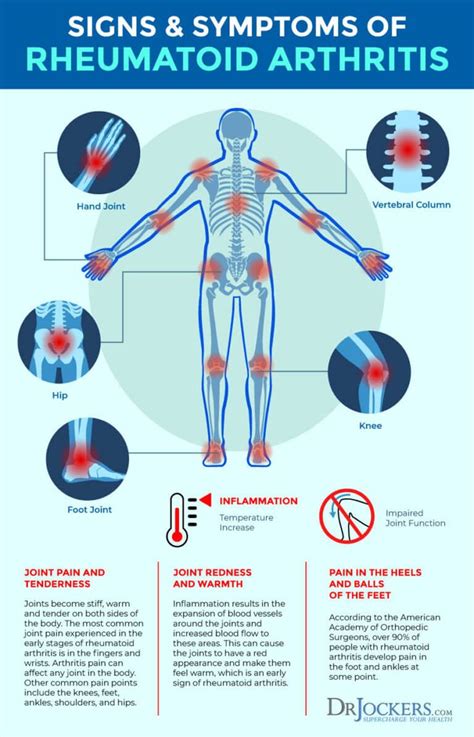 Rheumatoid Arthritis: Symptoms, Causes and Natural Support Strategies ...