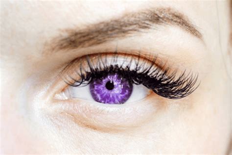 Alexandria's Genesis : Eyes, symptoms, mutation, and syndrome | FactDr