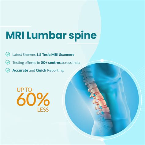 MRI Lumbar Spine Scan Price | MRI Lumbar Spine Scan starts at Rs.4500 ...