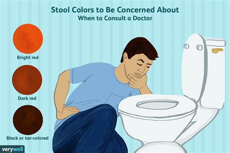 What Makes Light Colored Stools | Americanwarmoms.org