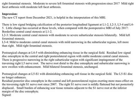 New mri results : r/Sciatica