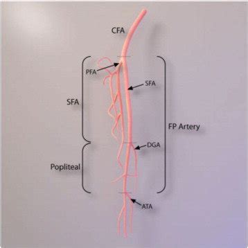 sfa abbreviation medical