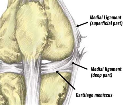 MCL Sprain - Symptoms, Treatment, Exercises & Rehabilitation (2022)