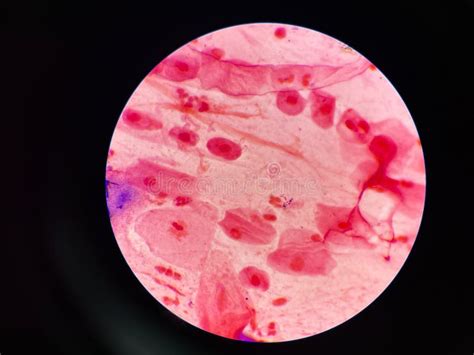 Bacteria Cell in Sputum Sample Gram Stain Method Stock Image - Image of ...