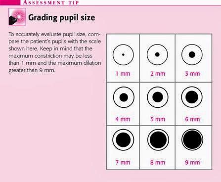 Pupil Size Chart In Neuro Success | Emergency nursing, Nursing school ...