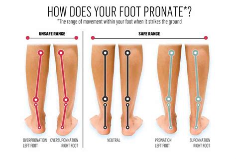 Correcting Foot Pronation (collapsing arches) with Corrective Exercise