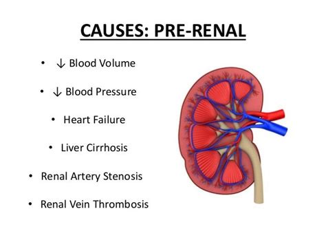 Renal Failure Causes - Effect of Dialysis on Bleeding Time in Chronic ...