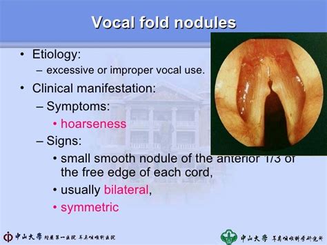 4 laryngeal disorders