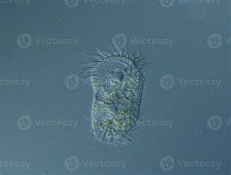 Ciliates and amoebas in drops of water under the microscope 12871233 ...