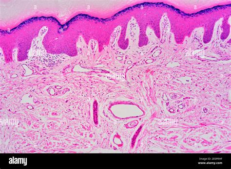 Dermal Papillae Histology