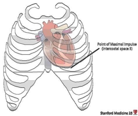 cardiac heave definition