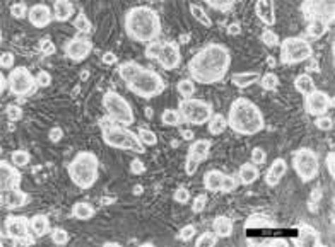 Mycoplasma Testing - Detection & Elimination