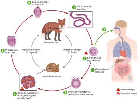 Echinococcus Granulosus Hydatid Cyst