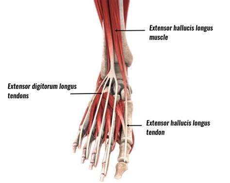 Extensor Tendonitis/Tendinopathy - Symptoms, Causes and Treatment