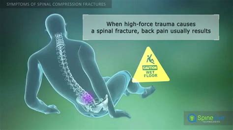 Stress fracture shin from fall symptoms - neryout