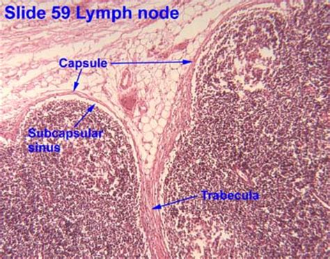 Reticular Connective Tissue Lymph Node