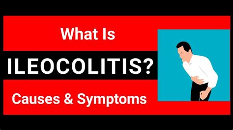 What Is Ileocolitis & It's Causes & Symptoms? | Gastromy Centre - YouTube