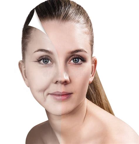 Woman`s Face before and after Rejuvenation. Stock Photo - Image of ...