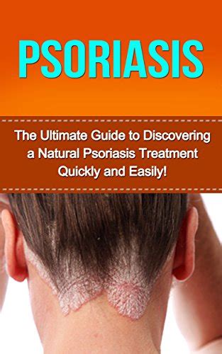 Psoriasis: The Ultimate Guide to Discovering a Natural Psoriasis ...