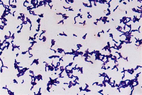 Gram-stain of C. jeddahense strain JCB T Figure 3. Transmission ...