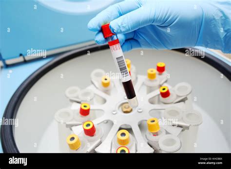 Medical laboratory centrifuge Stock Photo - Alamy