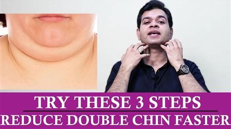 Best Exercises To Remove DOUBLE CHIN Quickly- How Double Chin Can Be ...