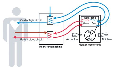 What is a Heater-Cooler Device? | FDA