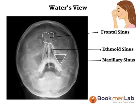 X-Ray PNS: Cost, Purpose, Procedure, Result [2024]