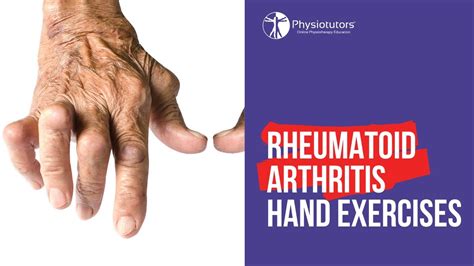 Rheumatoid Arthritis Hand Exercises | Mobility & Strength | Patient Talk