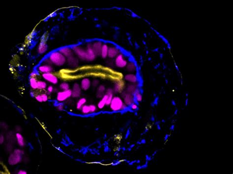 New human embryonic models bring hope for insights, but also lots of ...