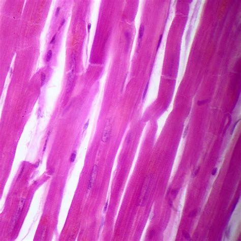 Human Cardiac Muscle Slide, 7 µm, H&E | Carolina Biological Supply