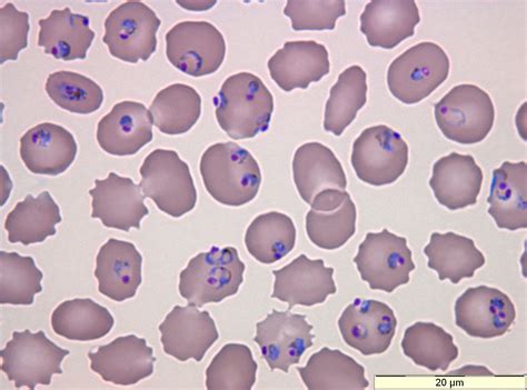 Plasmodium | Protozoa | Pinterest | Hematology, Lab tech and Medical ...