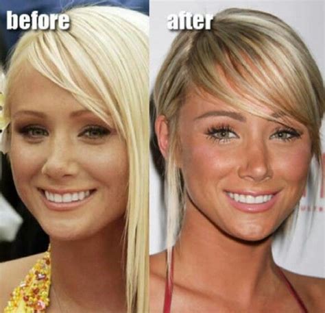 Before and After Plastic Surgery - Sara Underwood | Celebrity plastic ...