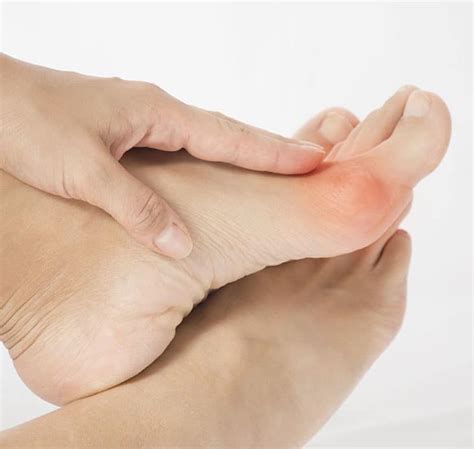 Learn About Different Foot Deformities - Michigan Foot & Ankle Specialists