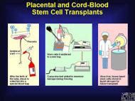 Cord Blood Stem Cell - Assignment Point