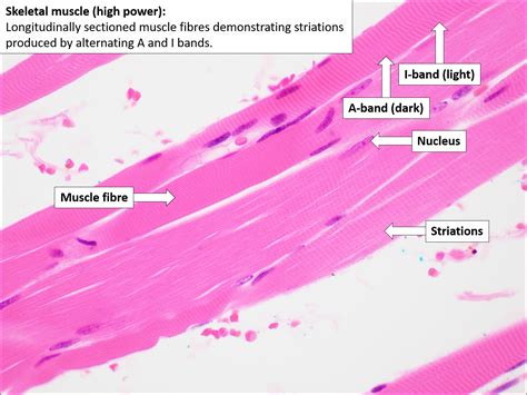 Skeletal Muscle – Normal Histology – Nus Pathweb | Free Download Nude ...