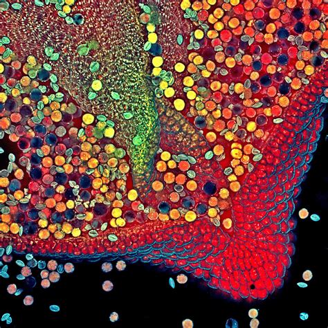 These Award-Winning Photos Of The Microscopic World Will Blow Your Mind ...