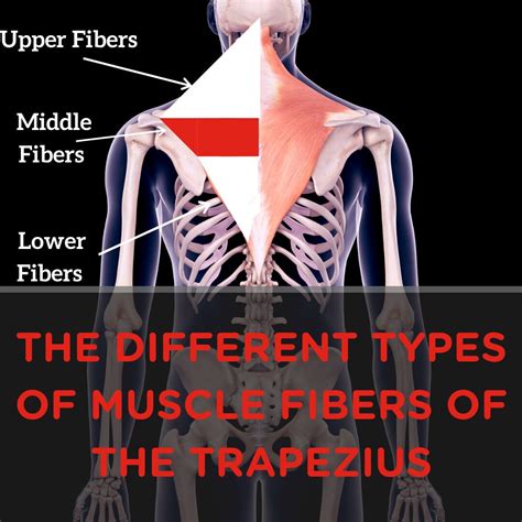 Trapezius Muscle Pain