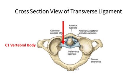 What Is the Atlantoaxial Joint? - Centeno-Schultz Clinic