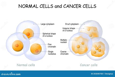 Cancer Cells and Normal Cells. Comparison and Difference Stock Vector ...