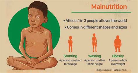 Malnutrition meaning, causes and prevention in Hindi - tfipost.in