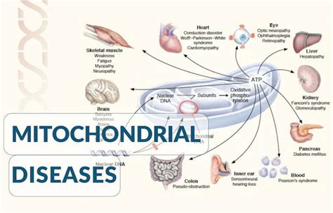 Mitochondrial diseases - Gene Solutions