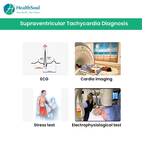 Supraventricular Tachycardia Causes Symptoms And Treatment | Images and ...