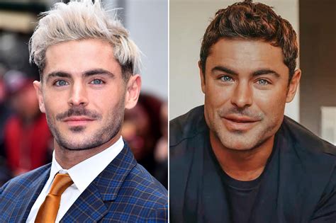 Zac Efron Plastic Surgery Video: Before & After Photos In 2022 - Has He ...