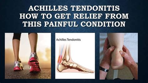 Can Tendonitis Travel Up Your Arm - TRAVELVOS